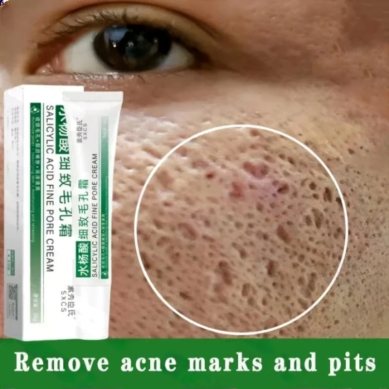 Collagen Peptide Powder - Krim Pembersih Pori Asam Salisilat Mengecilkan