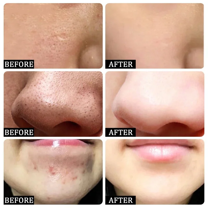 Krim Pembersih Pori Asam Salis - Collagen Peptide Powder ulasan dan harga