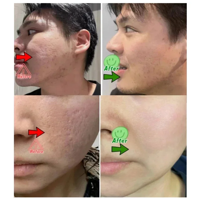 Krim Pembersih Pori Asam Salis - Collagen Peptide Powder ulasan dan harga