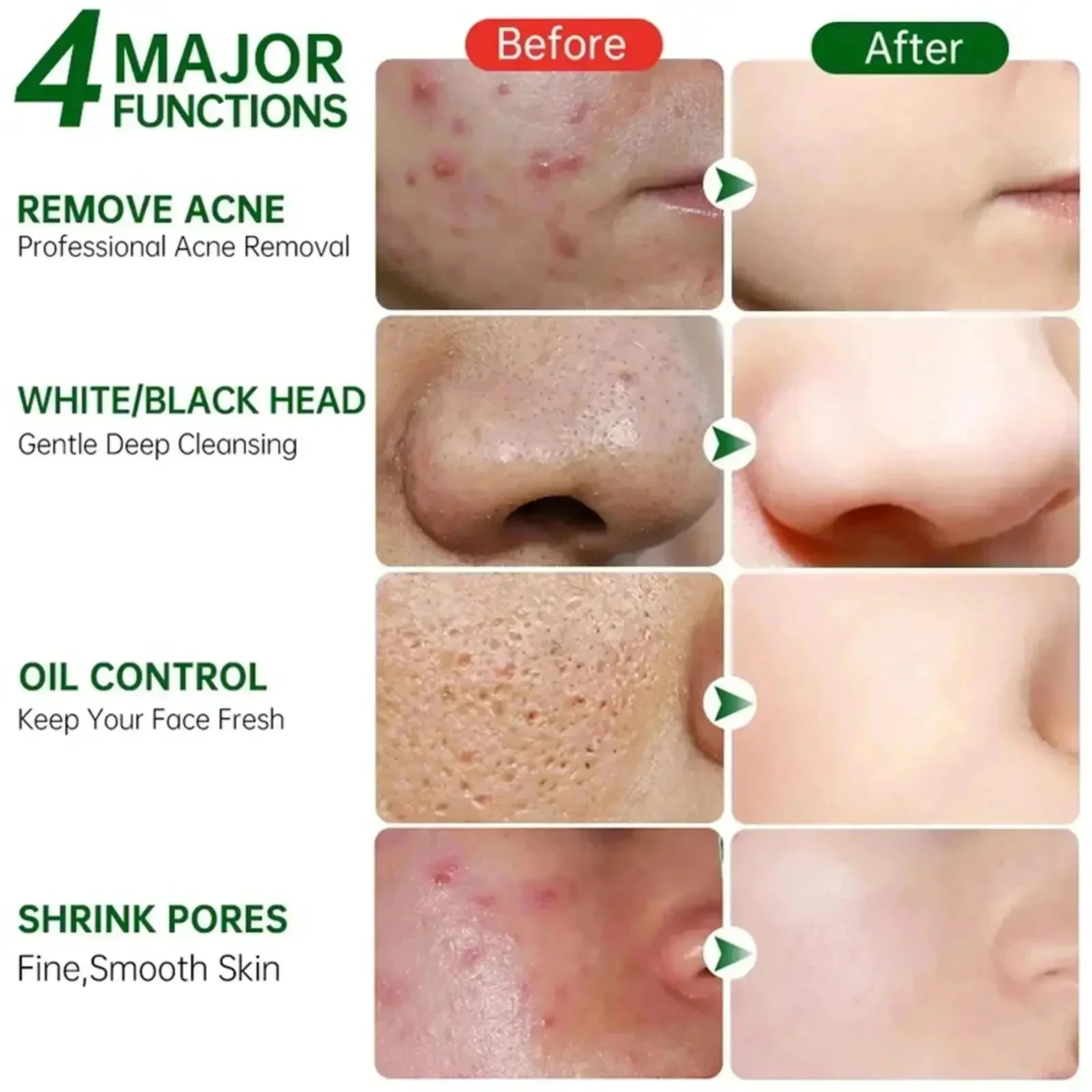 Krim Pembersih Pori Asam Salis - Collagen Peptide Powder ulasan dan harga